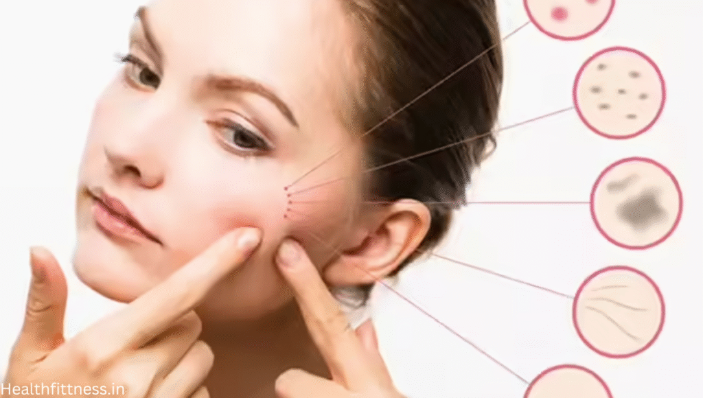 चेहरे पर पिंपल्स से छुटकारा पाने के 5 आसान और असरदार उपाय