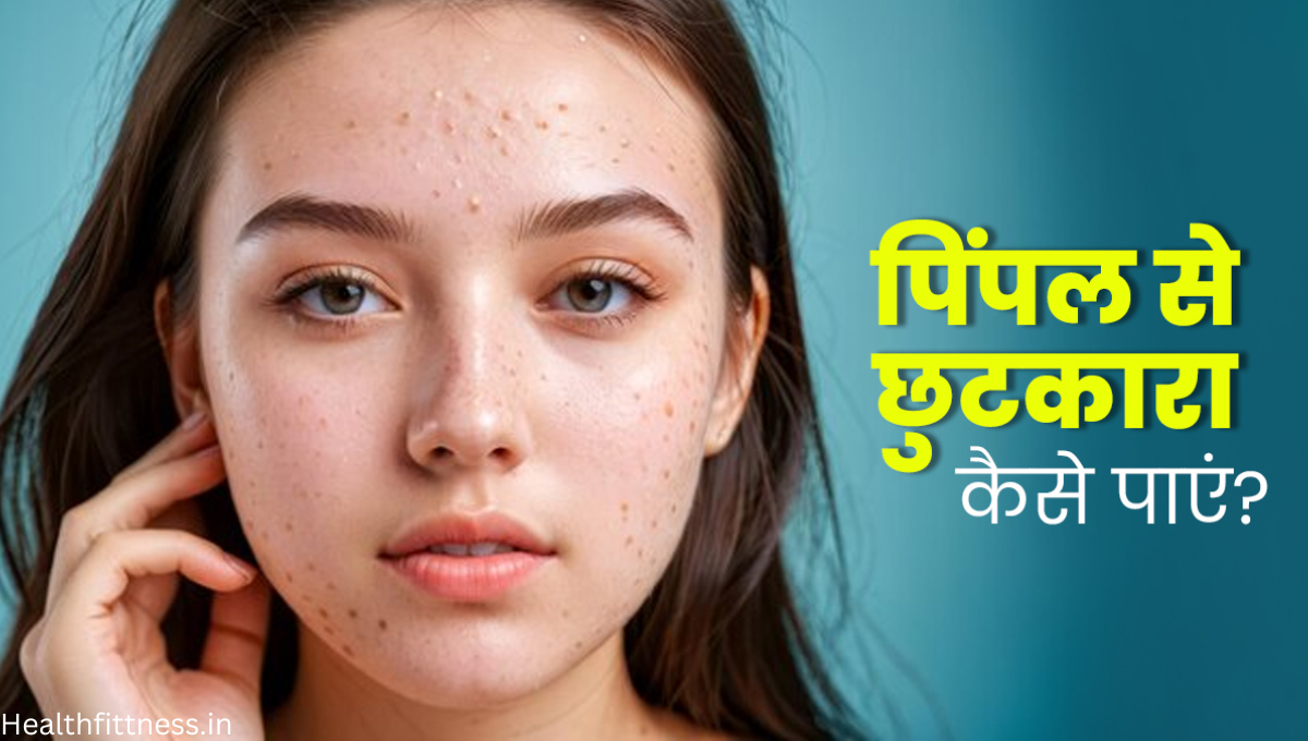 चेहरे पर पिंपल्स से छुटकारा पाने के 5 आसान और असरदार उपाय